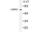 LIM Domain Kinase 2 antibody, LS-C176914, Lifespan Biosciences, Western Blot image 