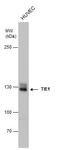Tyrosine Kinase With Immunoglobulin Like And EGF Like Domains 1 antibody, GTX103429, GeneTex, Western Blot image 