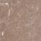 ABL Proto-Oncogene 2, Non-Receptor Tyrosine Kinase antibody, NBP2-68946, Novus Biologicals, Immunohistochemistry frozen image 