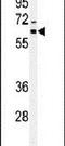 Immunity Related GTPase Q antibody, PA5-24856, Invitrogen Antibodies, Western Blot image 