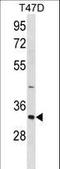 Hepatitis A Virus Cellular Receptor 2 antibody, LS-C157798, Lifespan Biosciences, Western Blot image 