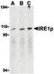 Endoplasmic Reticulum To Nucleus Signaling 1 antibody, LS-B8029, Lifespan Biosciences, Western Blot image 