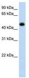 Hydroxyacid Oxidase 1 antibody, TA344134, Origene, Western Blot image 