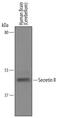 Secretin Receptor antibody, AF6387, R&D Systems, Western Blot image 