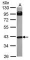 Type I inositol-1,4,5-trisphosphate 5-phosphatase antibody, PA5-28158, Invitrogen Antibodies, Western Blot image 