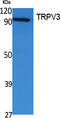 Transient receptor potential cation channel subfamily V member 3 antibody, A03874, Boster Biological Technology, Western Blot image 