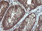 Galectin 3 antibody, LS-C788188, Lifespan Biosciences, Immunohistochemistry paraffin image 