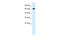 Tripartite Motif Containing 9 antibody, 28-206, ProSci, Enzyme Linked Immunosorbent Assay image 