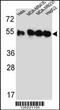 Tubulin Beta 4B Class IVb antibody, MBS9201167, MyBioSource, Western Blot image 