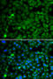 SET And MYND Domain Containing 4 antibody, 18-610, ProSci, Immunofluorescence image 