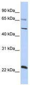Zinc Finger Protein 597 antibody, TA341481, Origene, Western Blot image 