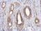 Leucine Rich Pentatricopeptide Repeat Containing antibody, PA5-30357, Invitrogen Antibodies, Immunohistochemistry paraffin image 