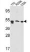 Prosaposin antibody, abx033374, Abbexa, Western Blot image 