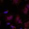 JunB Proto-Oncogene, AP-1 Transcription Factor Subunit antibody, GTX50105, GeneTex, Immunofluorescence image 