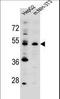 Potassium Channel Modulatory Factor 1 antibody, LS-C165407, Lifespan Biosciences, Western Blot image 