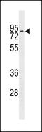 Zinc Finger Protein 551 antibody, 59-757, ProSci, Western Blot image 