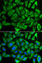 Cytochrome C, Somatic antibody, STJ23308, St John