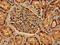 PDZ And LIM Domain 2 antibody, LS-C678966, Lifespan Biosciences, Immunohistochemistry paraffin image 