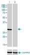 Ketohexokinase antibody, H00003795-M01, Novus Biologicals, Western Blot image 