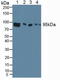 Aryl Hydrocarbon Receptor antibody, LS-C723567, Lifespan Biosciences, Western Blot image 