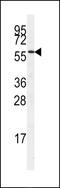 SRSF Protein Kinase 3 antibody, 62-976, ProSci, Western Blot image 