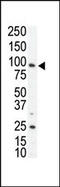 AXL Receptor Tyrosine Kinase antibody, 63-029, ProSci, Western Blot image 