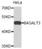 Beta-1,4-Galactosyltransferase 3 antibody, abx125551, Abbexa, Western Blot image 