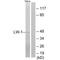 Heat Shock Transcription Factor Family, X-Linked 2 antibody, A19011, Boster Biological Technology, Western Blot image 