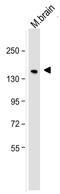 Neurofilament Medium antibody, 34-1000, Invitrogen Antibodies, Western Blot image 