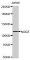 Nucleotide Binding Oligomerization Domain Containing 2 antibody, MBS126919, MyBioSource, Western Blot image 