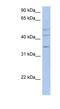 2-Phosphoxylose Phosphatase 1 antibody, NBP1-59507, Novus Biologicals, Western Blot image 