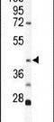 Keratin 19 antibody, PA5-12431, Invitrogen Antibodies, Western Blot image 