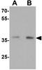 Mitochondrial Trans-2-Enoyl-CoA Reductase antibody, GTX31866, GeneTex, Western Blot image 