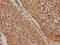 Tumor Protein P73 antibody, CSB-PA024092OA01HU, Cusabio, Immunohistochemistry frozen image 