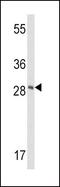 Frataxin antibody, GTX81888, GeneTex, Western Blot image 