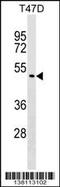 Zinc Finger Protein 557 antibody, 59-485, ProSci, Western Blot image 