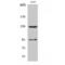 Gamma-Aminobutyric Acid Type B Receptor Subunit 1 antibody, LS-C383627, Lifespan Biosciences, Western Blot image 
