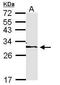 Tyrosine 3-Monooxygenase/Tryptophan 5-Monooxygenase Activation Protein Epsilon antibody, GTX113576, GeneTex, Western Blot image 