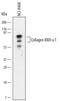 Collagen Type XXIII Alpha 1 Chain antibody, MAB4165, R&D Systems, Western Blot image 