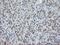 Phosphorylase Kinase Catalytic Subunit Gamma 2 antibody, NBP2-46393, Novus Biologicals, Immunohistochemistry paraffin image 
