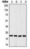 Von Hippel-Lindau Tumor Suppressor antibody, LS-C352988, Lifespan Biosciences, Western Blot image 