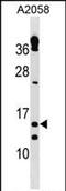 Thioredoxin reductase 3 intronic transcript 1 antibody, PA5-72112, Invitrogen Antibodies, Western Blot image 