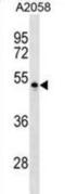 Nectin Cell Adhesion Molecule 4 antibody, abx029867, Abbexa, Western Blot image 