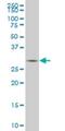 TGFB Induced Factor Homeobox 2 antibody, H00060436-M06, Novus Biologicals, Western Blot image 