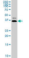 Troponin T2, Cardiac Type antibody, LS-C139203, Lifespan Biosciences, Western Blot image 