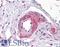 Transcriptional regulator ERG antibody, LS-B4864, Lifespan Biosciences, Immunohistochemistry paraffin image 