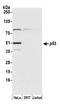 p53 antibody, A300-249A, Bethyl Labs, Western Blot image 