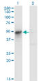 Argininosuccinate Lyase antibody, LS-C196699, Lifespan Biosciences, Western Blot image 