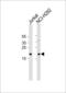TATA-Box Binding Protein Associated Factor 10 antibody, 60-151, ProSci, Western Blot image 