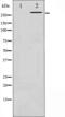 Filamin A antibody, abx010787, Abbexa, Western Blot image 